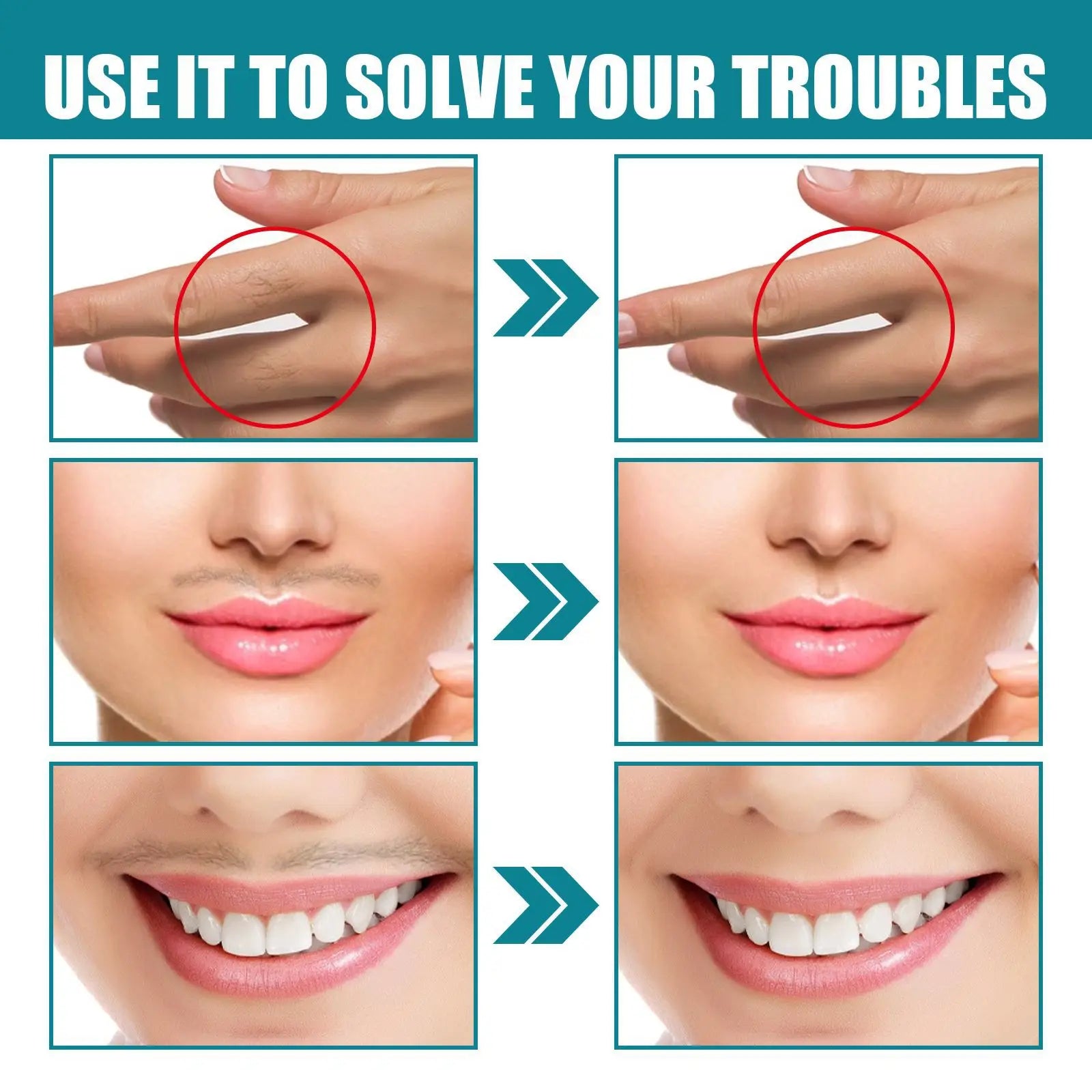 Jaysuing Facial Lip Hair Removal Cream Fast Removes Hair, Cleans and Smoothens the Skin, and Is Gentle and Non-irritating 100g
